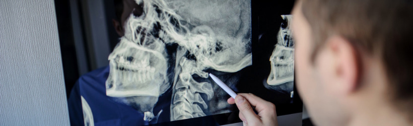 Chondrosarcome à Casablanca, prise en charge par le Dr Rita Bentahila, oncologue-radiothérapeute