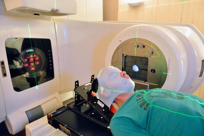 العلاج الإشعاعي المجسم (SBRT) الدار البيضاء