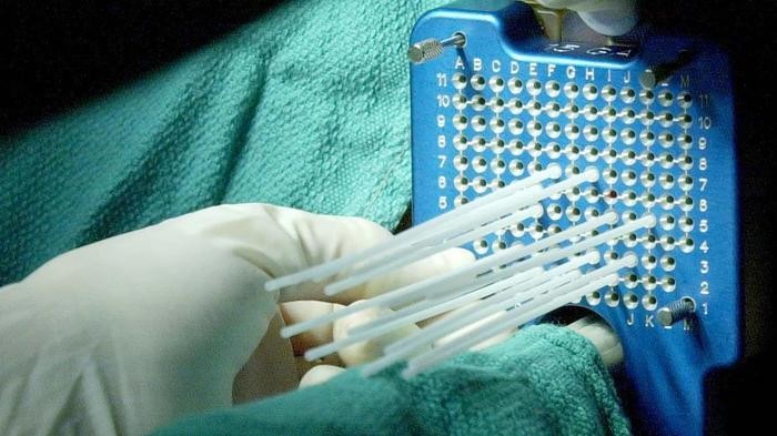 Curiethérapie Casablanca