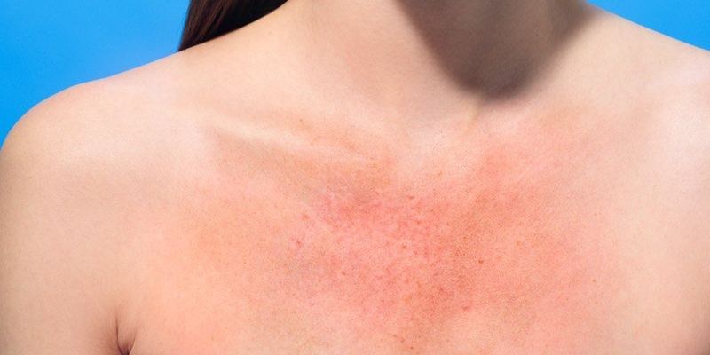 Effets secondaires de la radiothérapie : ce qu'il faut savoir au Maroc Casablanca