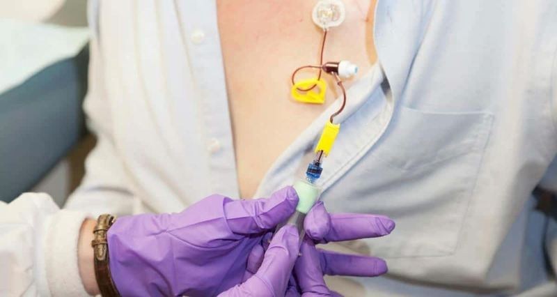 Radiothérapie ou chimiothérapie : quelle différence au Maroc ? Casablanca