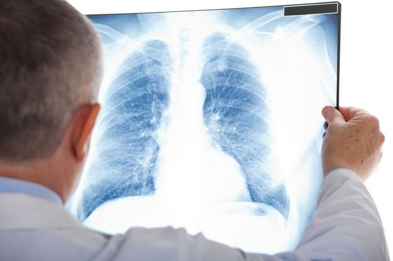 Toux persistante : est-ce un signe de cancer ? Casablanca